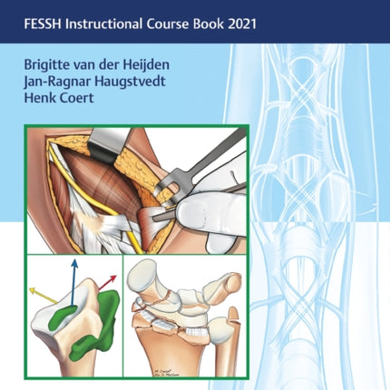 Management of Complications in Common Hand and