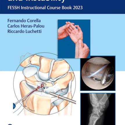 Carpal Ligament Injuries and Instability