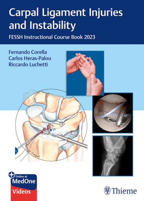 Carpal Ligament Injuries and Instability