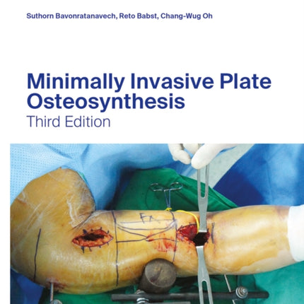 Minimally Invasive Plate Osteosynthesis