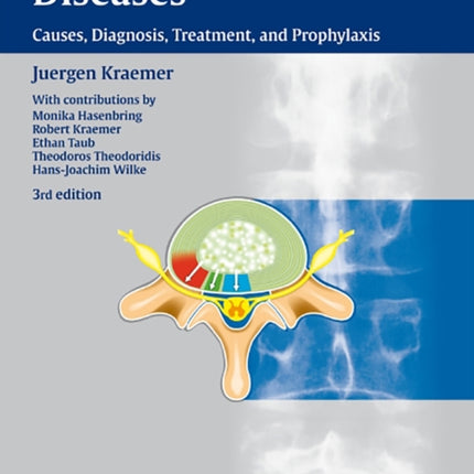 Intervertebral Disk Diseases: Causes, Diagnosis, Treatment and Prophylaxis