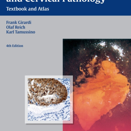 Burghardt's Colposcopy and Cervical Pathology: Textbook and Atlas