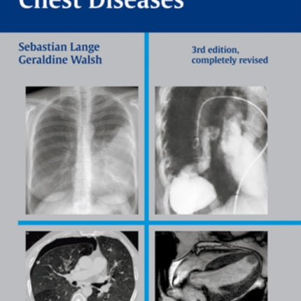 Radiology of Chest Diseases