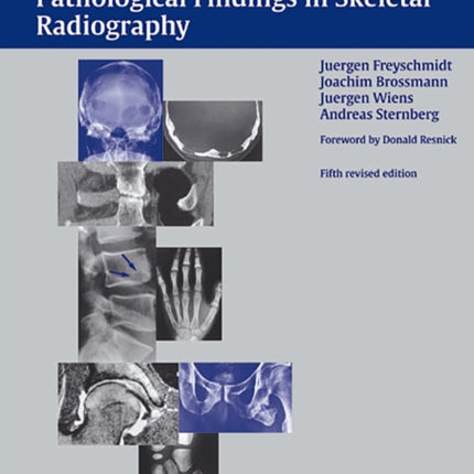 Freyschmidt's "Koehler/Zimmer" Borderlands of Normal and Early Pathological Findings in Skeletal Radiography