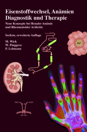 Eisenstoffwechsel, Anämien Therapie und Diagnose: Neue Konzepte bei Renaler Anämie und Rheumatoider Arthritis