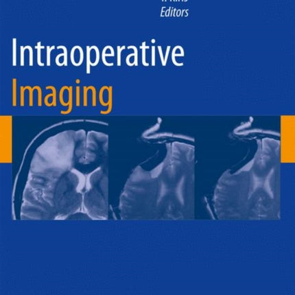 Intraoperative Imaging