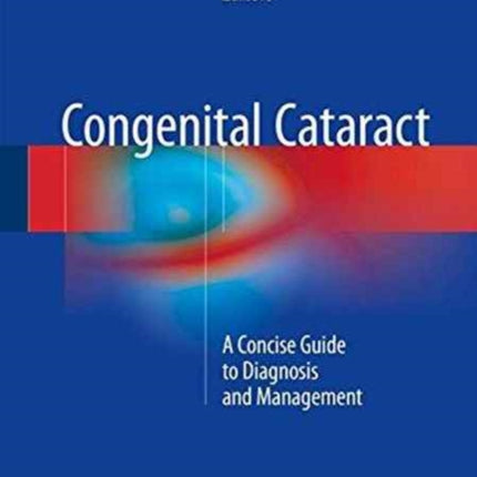 Congenital Cataract: A Concise Guide to Diagnosis