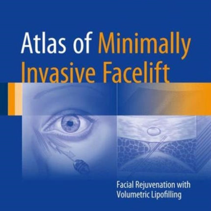 Atlas of Minimally Invasive Facelift: Facial Rejuvenation with Volumetric Lipofilling