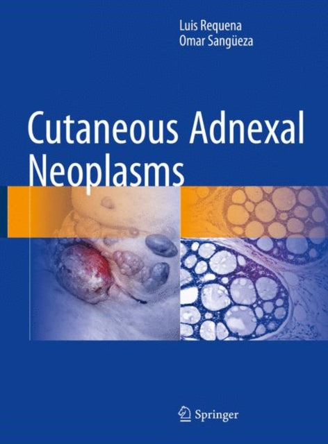 Cutaneous Adnexal Neoplasms