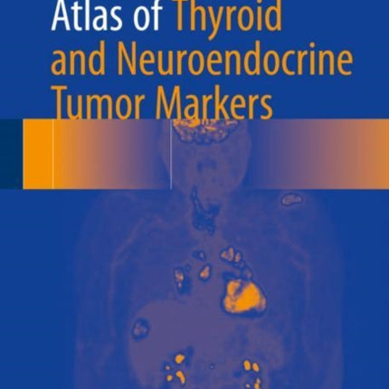 Atlas of Thyroid and Neuroendocrine Tumor Markers