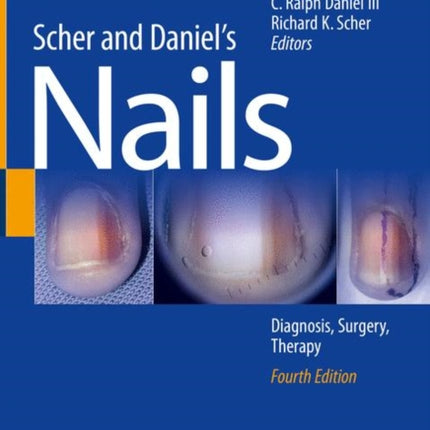 Scher and Daniel's Nails: Diagnosis, Surgery, Therapy