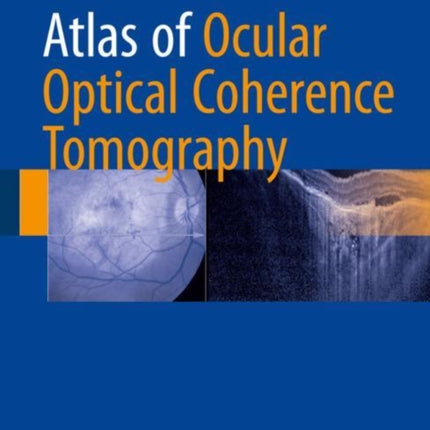 Atlas of Ocular Optical Coherence Tomography