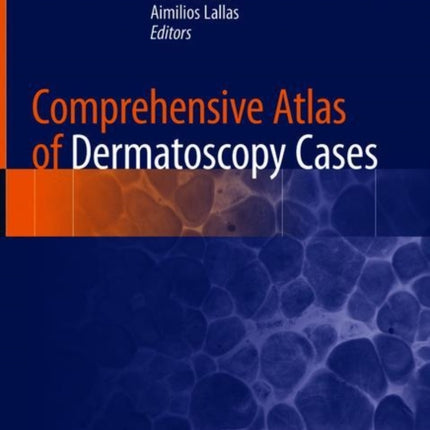 Comprehensive Atlas of Dermatoscopy Cases