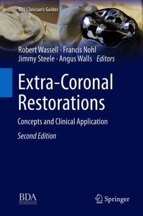 Extra-Coronal Restorations: Concepts and Clinical Application