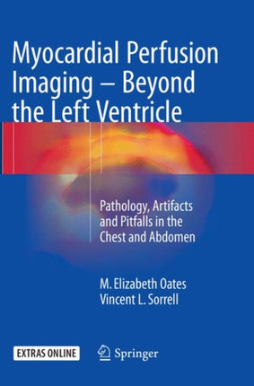 Myocardial Perfusion Imaging - Beyond the Left