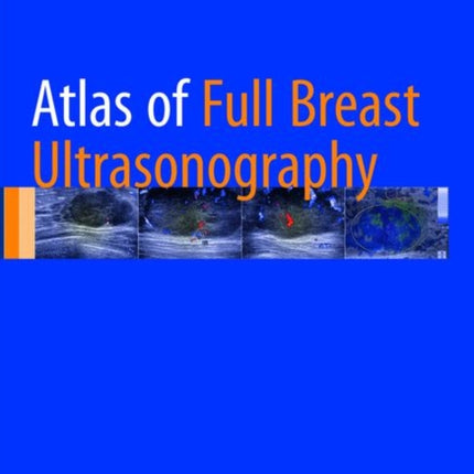 Atlas of Full Breast Ultrasonography