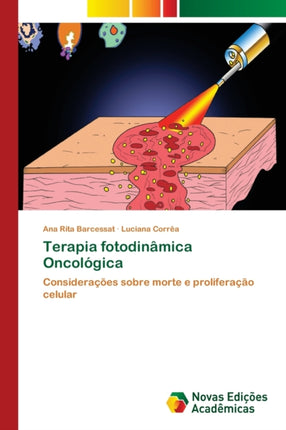 Terapia fotodinâmica Oncológica