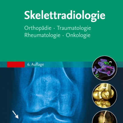 Skelettradiologie Orthopdie Traumatologie Rheumatologie Onkologie