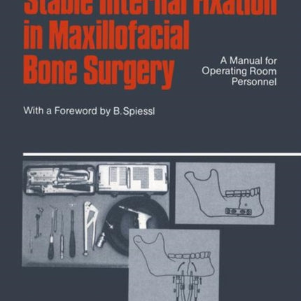 Stable Internal Fixation in Maxillofacial Bone Surgery: A Manual for Operating Room Personnel