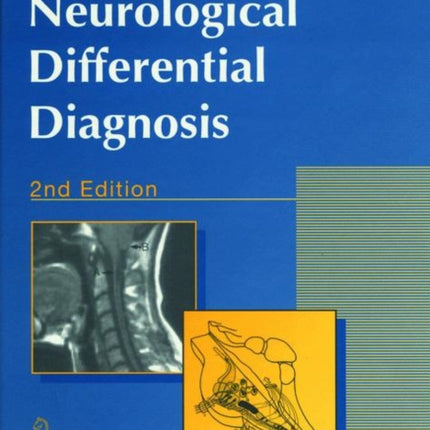 Neurological Differential Diagnosis