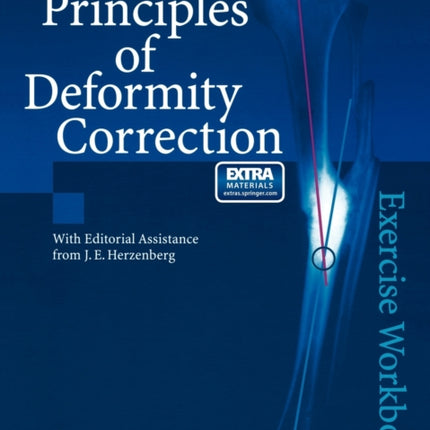 Principles of Deformity Correction: Exercise