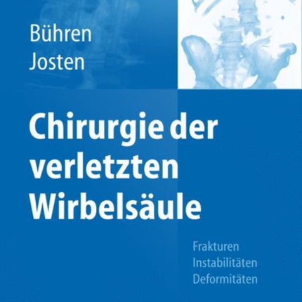Chirurgie der verletzten Wirbelsäule: Frakturen,