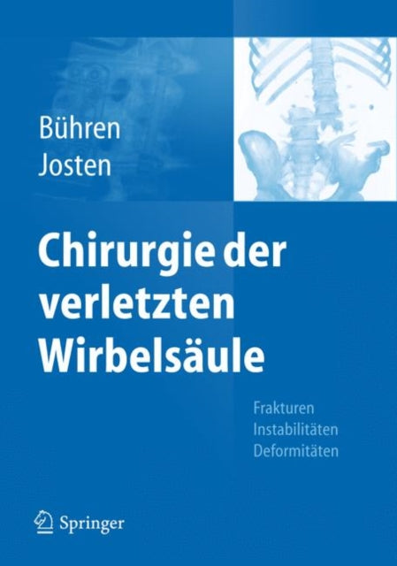 Chirurgie der verletzten Wirbelsäule: Frakturen,