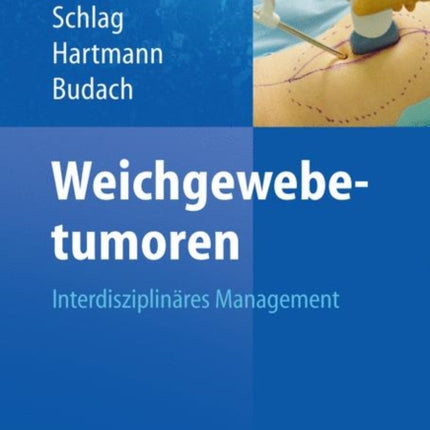 Weichgewebetumoren: Interdisziplinäres Management