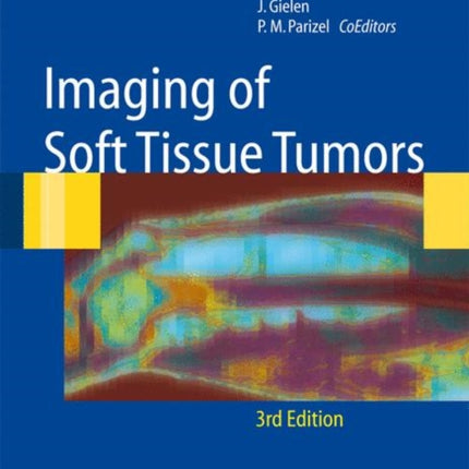 Imaging of Soft Tissue Tumors