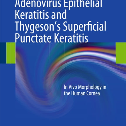 Adenovirus Epithelial Keratitis and Thygeson's