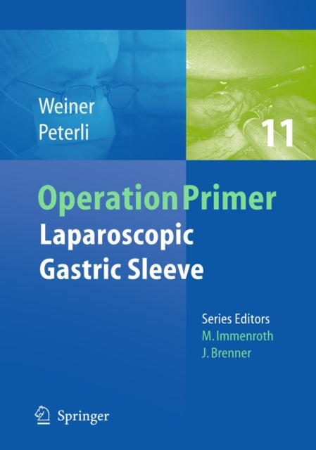 Laparoscopic Gastric Sleeve