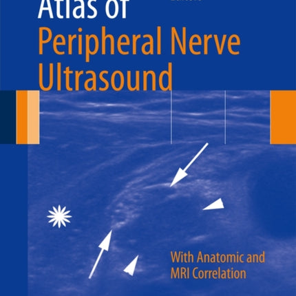 Atlas of Peripheral Nerve Ultrasound: With Anatomic and MRI Correlation