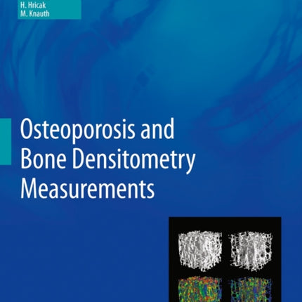 Osteoporosis and Bone Densitometry Measurements