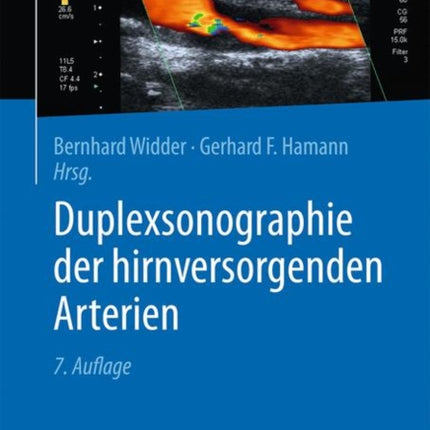 Duplexsonographie der hirnversorgenden Arterien