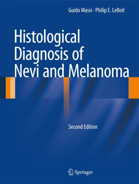 Histological Diagnosis of Nevi and Melanoma