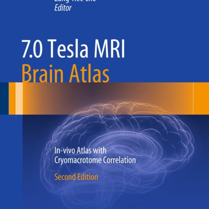 7.0 Tesla MRI Brain Atlas: In-vivo Atlas with