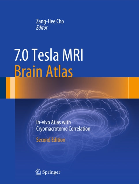 7.0 Tesla MRI Brain Atlas: In-vivo Atlas with