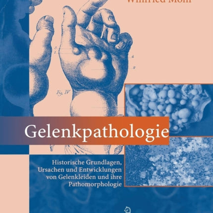 Gelenkpathologie: Historische Grundlagen,