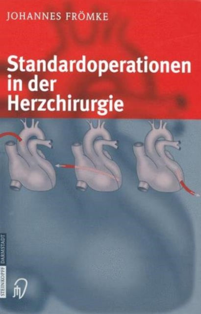 Standardoperationen in der Herzchirurgie