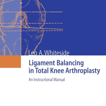 Ligament Balancing in Total Knee Arthroplasty: An Instructional Manual