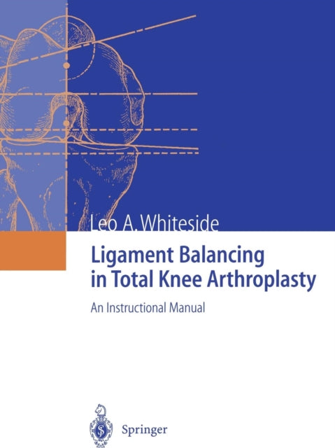 Ligament Balancing in Total Knee Arthroplasty: An Instructional Manual