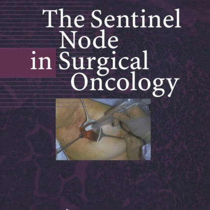 The Sentinel Node in Surgical Oncology