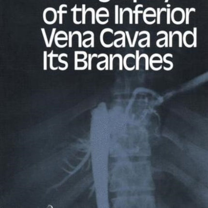 Venography of the Inferior Vena Cava and Its Branches