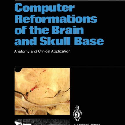 Computer Reformations of the Brain and Skull Base: Anatomy and Clinical Application