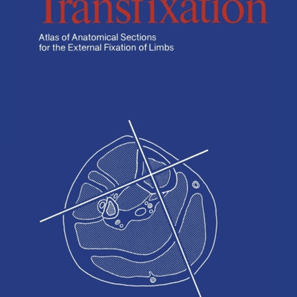 Transfixation: Atlas of Anatomical Sections for the External Fixation of Limbs