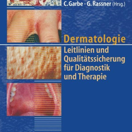 Dermatologie: Leitlinien und Qualitätssicherung