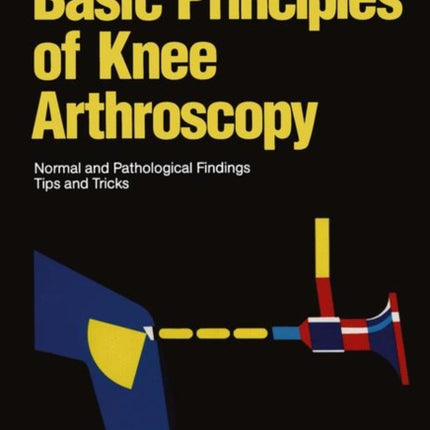 Basic Principles of Knee Arthroscopy: Normal and Pathological Findings Tips and Tricks