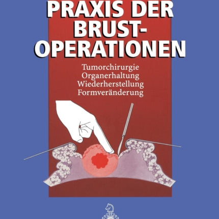 Praxis der Brustoperationen: Tumorchirurgie — Organerhaltung — Wiederherstellung — Formveränderung