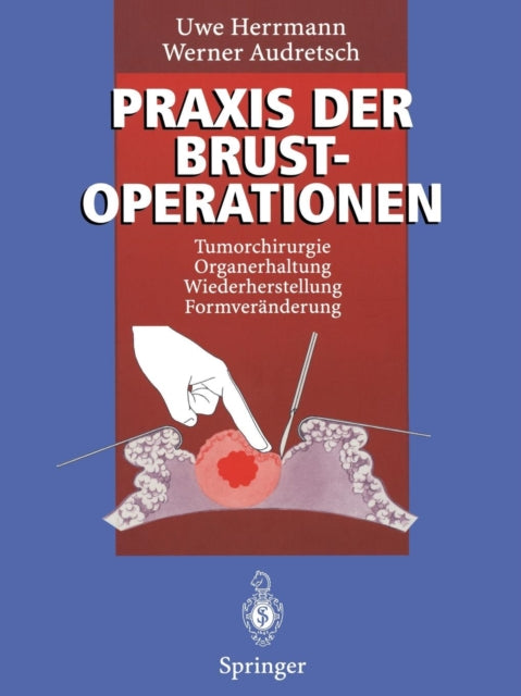 Praxis der Brustoperationen: Tumorchirurgie — Organerhaltung — Wiederherstellung — Formveränderung