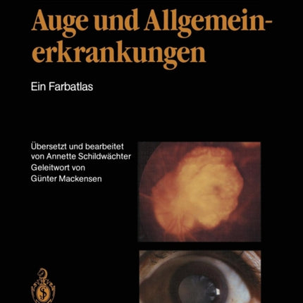 Auge und Allgemeinerkrankungen: Ein Farbatlas